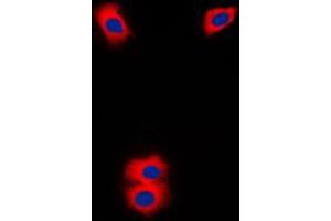 Immunofluorescence (IF) image for anti-Cytochrome P450, Family 11, Subfamily A, Polypeptide 1 (CYP11A1) (C-Term) antibody (ABIN7295466)