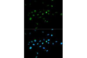 Immunofluorescence analysis of A549 cell using TRIM63 antibody. (TRIM63 抗体)