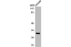 Western Blot analysis of HuvEc cells using ABHD11 Polyclonal Antibody (ABHD11 抗体  (Internal Region))