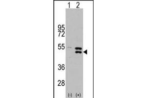 Western blot analysis of P2K5 (arrow) using rabbit polyclonal P2K5 Antibody  f. (MAP2K5 抗体  (AA 127-156))