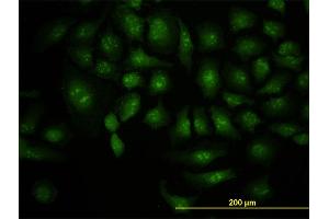Immunofluorescence of monoclonal antibody to DCP1A on HeLa cell. (DCP1A 抗体  (AA 186-285))