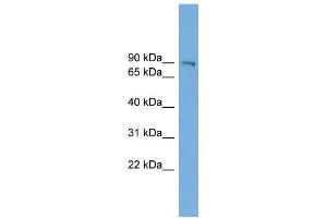WB Suggested Anti-UTP14A Antibody Titration: 0. (UTP14A 抗体  (N-Term))