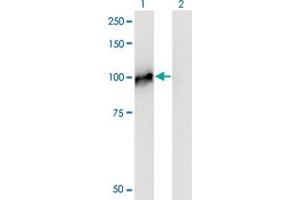 Western Blot analysis of NCAPH expression in transfected 293T cell line by NCAPH monoclonal antibody (M01), clone 1C9. (NCAPH 抗体  (AA 645-741))