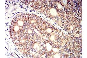 Immunohistochemistry (IHC) image for anti-Killer Cell Immunoglobulin-Like Receptor, three Domains, Long Cytoplasmic Tail, 1 (KIR3DL1) (AA 22-340) antibody (ABIN5611328)