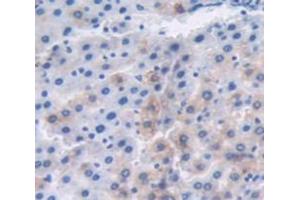 DAB staining on fromalin fixed paraffin- embedded Kidney tissue) (MT1 抗体  (AA 1-61))