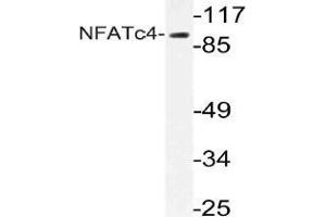 Western blot (WB) analysis of NFATc4 antibody in extracts from 293 cells. (NFATC4 抗体)