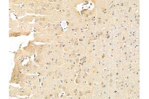 ABIN6261783 and ABIN6268901 at 1/100 staining Rat brain tissue by IHC-P. (c-FOS 抗体  (N-Term))