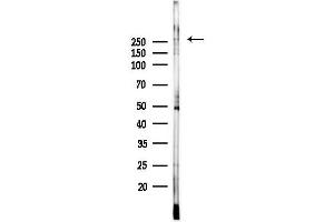 Western blot analysis of lysates from Hela cells(UV, 30 min treatment), using CACNE Antibody at 1/1000 dilution.
