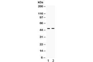 Western blot testing of human 1) HeLa and 2) A549 cell lysate with ING1 antibody.
