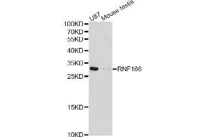 Western blot analysis of extracts of various cell lines, using RNF166 antibody (ABIN4905019) at 1:1000 dilution. (RNF166 抗体)