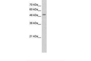 Image no. 2 for anti-serine/threonine Kinase 11 (STK11) (AA 71-120) antibody (ABIN203483) (LKB1 抗体  (AA 71-120))