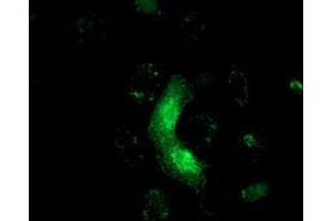 Anti-MRAS mouse monoclonal antibody (ABIN2454547) immunofluorescent staining of COS7 cells transiently transfected by pCMV6-ENTRY MRAS (RC212259). (MRAS 抗体)