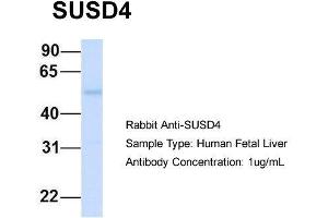 Host:  Rabbit  Target Name:  SUSD4  Sample Type:  Human Fetal Liver  Antibody Dilution:  1. (SUSD4 抗体  (N-Term))