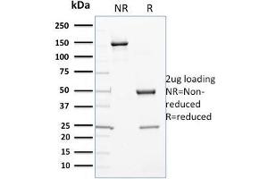 SDS-PAGE Analysis Purified Cytochrome P450 1A1/1A2 Mouse Monoclonal Antibody (P6). (CYP3A1 抗体)