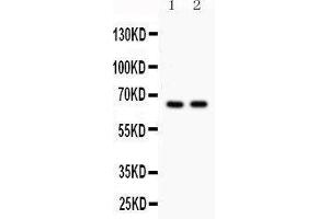Anti- Cdc25B Picoband antibody, Western blotting All lanes: Anti Cdc25B  at 0. (CDC25B 抗体  (AA 119-248))
