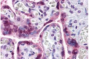 Human Placenta: Formalin-Fixed, Paraffin-Embedded (FFPE) (TCF12 抗体  (N-Term))