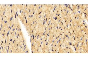 Detection of CAV1 in Rat Cardiac Muscle Tissue using Polyclonal Antibody to Caveolin 1 (CAV1) (Caveolin-1 抗体  (AA 2-105))