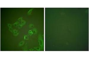 Immunofluorescence analysis of A549 cells, using Synuclein beta Antibody. (beta Synuclein 抗体  (AA 85-134))