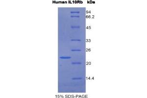 SDS-PAGE analysis of Human IL10Rb Protein. (IL10RB 蛋白)
