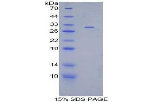 SDS-PAGE (SDS) image for Angiopoietin-Like 2 (ANGPTL2) (AA 267-493) protein (His tag) (ABIN1880044)