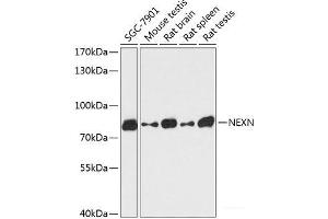 Western blot analysis of extracts of various cell lines using NEXN Polyclonal Antibody at dilution of 1:3000. (NEXN 抗体)