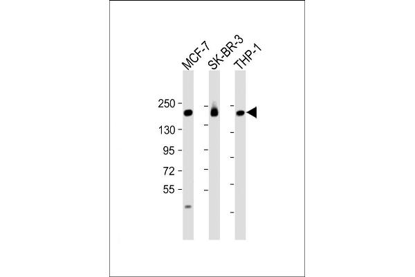 PREX1 抗体  (C-Term)