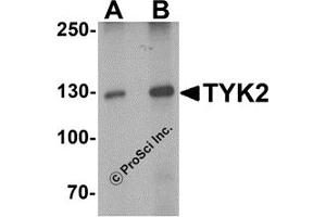 Western Blotting (WB) image for anti-Tyrosine Kinase 2 (TYK2) (N-Term) antibody (ABIN1077422) (TYK2 抗体  (N-Term))