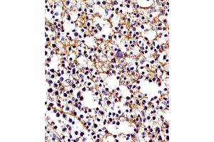 (ABIN654625 and ABIN2844322) staining D11b in human tonsil tissue sections by Immunohistochemistry (IHC-P - paraformaldehyde-fixed, paraffin-embedded sections). (CD11b 抗体  (N-Term))