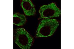 Immunofluorescent staining of A549 cell reacted with TUBB monoclonal antibody  at 1:25 dilution. (TUBB 抗体)