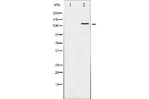 Western blot analysis of HDAC5 phosphorylation expression in NIH-3T3 whole cell lysates,The lane on the left is treated with the antigen-specific peptide. (HDAC5 抗体  (pSer498))