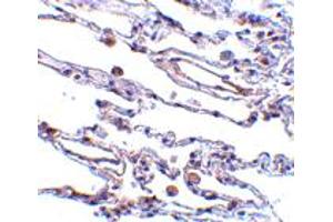 Immunohistochemistry of TRAF3IP2 in human lung tissue with TRAF3IP2 polyclonal antibody  at 5 ug/mL . (TRAF3IP2 抗体  (AA 554-568))