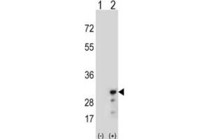 Western Blotting (WB) image for anti-Peroxiredoxin 3 (PRDX3) antibody (ABIN3001722) (Peroxiredoxin 3 抗体)