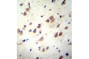 Immunohistochemistry (Paraffin-embedded Sections) (IHC (p)) image for anti-Glutamate Receptor, Ionotropic, N-Methyl D-Aspartate 3B (GRIN3B) (AA 903-933), (C-Term) antibody (ABIN952631)