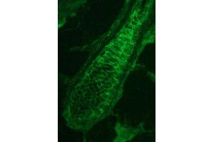 Image no. 1 for anti-Plakophilin 3 (PKP3) antibody (ABIN335358) (Plakophilin 3 抗体)