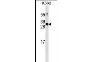 CS antibody ABIN658915 western blot analysis in K562 cell line lysates (35 μg/lane). (APCS 抗体)