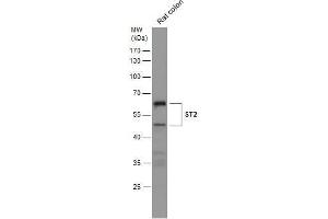 WB Image Rat tissue extract (50 μg) was separated by 10% SDS-PAGE, and the membrane was blotted with ST2 antibody [N1C1] , diluted at 1:500. (IL1RL1 抗体)