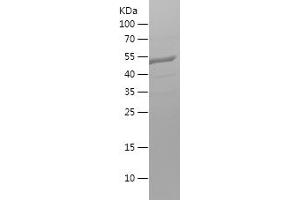 alpha Adaptin Protein (AA 601-747) (His-IF2DI Tag)