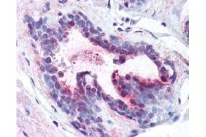 Image no. 1 for anti-Programmed Cell Death 4 (PDCD4) (pSer457), (Ser457) antibody (ABIN401369) (PDCD4 抗体  (pSer457, Ser457))