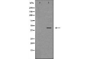 Western blot analysis of SW480 cell lysate, using HSD17B2 Antibody. (HSD17B2 抗体  (C-Term))