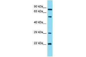 Western Blotting (WB) image for anti-Guanylate Cyclase 1, Soluble, alpha 2 (GUCY1A2) (N-Term) antibody (ABIN2791570) (GUCY1A2 抗体  (N-Term))