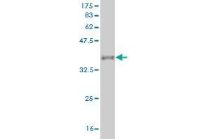 Western Blot detection against Immunogen (37. (PGA5 抗体  (AA 203-306))