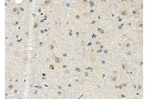 ABIN6257219 and ABIN6276016 at 1/100 staining Rat brain tissue by IHC-P. (GPR153 抗体  (Internal Region))