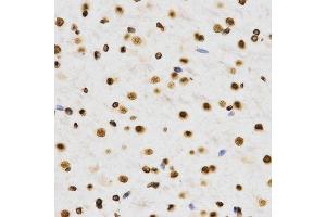 Immunohistochemistry (Paraffin-embedded Sections) (IHC (p)) image for anti-Histone 3 (H3) (H3K9me2) antibody (ABIN3023260)