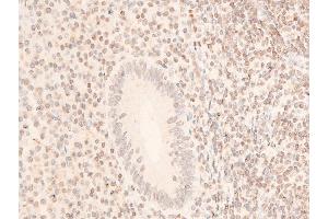 ABIN6267072 at 1/100 staining human appendiceal tissue sections by IHC-P.