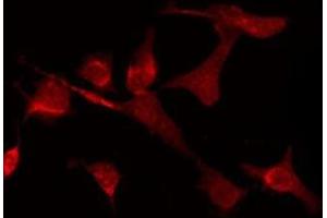 ABIN6275139 staining LOVO by IF/ICC. (GABRD 抗体  (Internal Region))