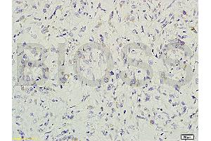 Formalin-fixed and paraffin embedded rat small intestine tissue labeled with Rabbit Anti-gremlin Polyclonal Antibody (ABIN687082) at 1:200 followed by conjugation to the secondary antibody and DAB staining. (GREM1 抗体  (AA 101-184))