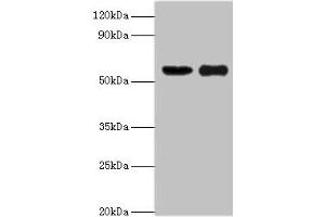 Western blot All lanes: OXCT1 antibody at 8 μg/mL Lane 1: Mouse heart tissue Lane 2: Mouse kidney tissue Secondary Goat polyclonal to rabbit IgG at 1/10000 dilution Predicted band size: 57, 14 kDa Observed band size: 57 kDa (OXCT1 抗体  (AA 261-520))