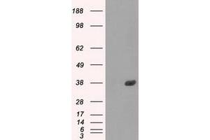 Image no. 9 for anti-Fc gamma RII (CD32) antibody (ABIN1497254) (Fc gamma RII (CD32) 抗体)