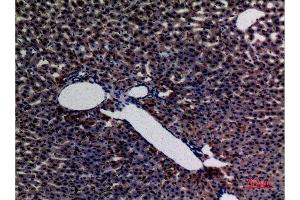 Immunohistochemistry (IHC) image for anti-Amylase (AMY) (N-Term) antibody (ABIN3187706)