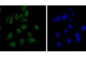 Immunofluorescence analysis of Hela cells using CHD3 mouse mAb (green). (CHD3 抗体)